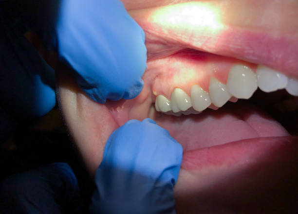 Best Emergency TMJ Treatment in Edmonston, MD