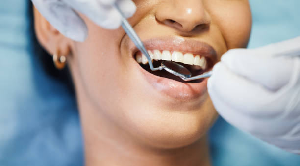 Best Emergency Treatment for Dental Infections or Abscesses in Edmonston, MD